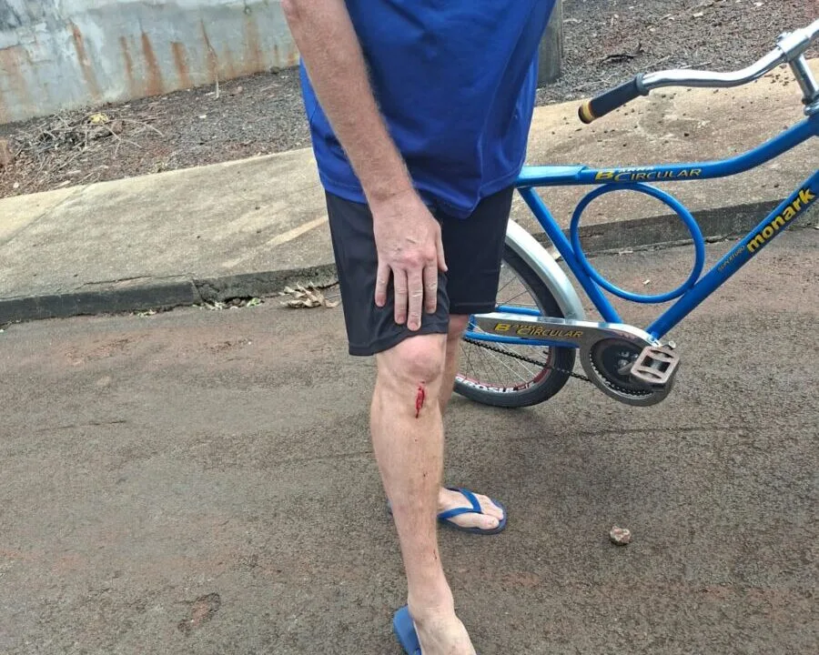 BORRAZÓPOLIS – Ataque de cachorro deixa ciclista ferido na Rua Alagoas